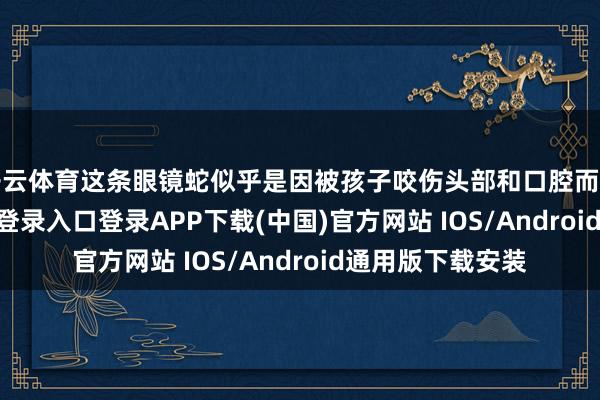 开云体育这条眼镜蛇似乎是因被孩子咬伤头部和口腔而弃世-开云kaiyun登录入口登录APP下载(中国)官方网站 IOS/Android通用版下载安装