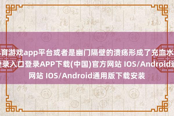 体育游戏app平台或者是幽门隔壁的溃疡形成了充血水肿-开云kaiyun登录入口登录APP下载(中国)官方网站 IOS/Android通用版下载安装